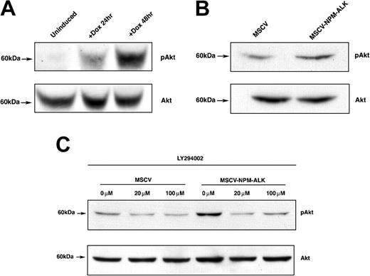 Figure 2. AKT is phosphorylated on Ser473 in N/A-Ba/F3 cells in a PI 3-kinase-dependent manner. (A) Time-dependent AKT phosphorylation in TonBaF.1 cells inducibly expressing NPM-ALK 24 hours and 48 hours after the addition of 2 μg/mL doxycycline. Uninduced samples were harvested from cells starved of IL-3 for 17 hours. +Dox 24-hour and +Dox 48-hour samples were harvested from cells starved of IL-3 for 17 hours and induced with 2 μg/mL doxycycline for 24 hours and 48 hours, respectively. Whole-cell lysates were fractionated by SDS-PAGE and immunoblotted with phospho-AKT (Ser473)-specific antibody. The membrane was stripped and reblotted with AKT-specific antibody to confirm equal expression. (B) AKT is constitutively phosphorylated in Ba/F3 cells stably transformed with NPM-ALK. Whole-cell lysates of MSCV- and MSCV-NPM-ALK-transduced Ba/F3 cells were harvested after a 17-hour IL-3 starvation, fractionated by SDS-PAGE, and immunoblotted with phospho-AKT (Ser473)-specific antibody. The membrane was stripped and reblotted with AKT-specific antibody to confirm equal expression. (C) NPM-ALK-induced phosphorylation of AKT (Ser473) is PI 3-kinase-dependent. Whole-cell lysates of MSCV- and MSCV-NPM-ALK-transduced Ba/F3 cells were harvested after a 17-hour IL-3 starvation and 1-hour exposure to 0 μM, 20 μM, or 100 μM PI 3-kinase-specific inhibitor LY294002. Equal amounts of protein were fractionated by SDS-PAGE and immunoblotted with phospho-AKT (Ser473)-specific antibody. The membrane was stripped and reblotted with AKT-specific antibody to confirm equal expression.