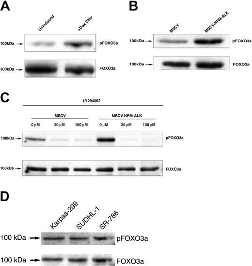 Figure 3. FOXO3a is phosphorylated on Thr32 in Ba/F3 cells stably or inducibly expressing NPM-ALK. (A) FOXO3a phosphorylation in TonBaF.1 cells inducibly expressing NPM-ALK 24 hours after the addition of 2 μg/mL doxycycline. Uninduced samples were harvested from cells starved of IL-3 for 17 hours. +Dox 24hr samples were harvested from cells starved of IL-3 for 17 hours and induced with 2 μg/mL doxycycline for 24 hours. Whole-cell lysates were fractionated by SDS-PAGE and immunoblotted with phospho-FOXO3a (Thr32)-specific antibody. The membrane was stripped and reblotted with FOXO3a-specific antibody to confirm equal expression. (B) FOXO3a is constitutively phosphorylated in Ba/F3 cells stably transformed with NPM-ALK. Whole-cell lysates of MSCV- and MSCV-NPM-ALK-transduced Ba/F3 cells were harvested after a 17-hour IL-3 starvation, fractionated by SDS-PAGE, and immunoblotted with phospho-FOXO3a (Thr32)-specific antibody. The membrane was stripped and reblotted with FOXO3a-specific antibody to confirm equal expression. (C) NPM-ALK-induced phosphorylation of FOXO3a (Thr32) is dependent on PI 3-kinase activity. Whole-cell lysates of MSCV- and MSCV-NPM-ALK-transduced Ba/F3 cells were harvested after a 17-hour IL-3 starvation and 1-hour exposure to 0 μM, 20 μM, or 100 μM of the PI 3-kinase-specific inhibitor LY294002. Equal amounts of protein were fractionated by SDS-PAGE and immunoblotted with phospho-FOXO3a (Thr32)-specific antibody. The membrane was stripped and reblotted with FOXO3a-specific antibody to confirm equal expression. (D) Constitutive phosphorylation of FOXO3a in human NPM-ALK-positive ALCL cell lines. Whole-cell lysates of Karpas-299, SUDHL-1, and SR-786 cells were fractionated by SDS-PAGE and immunoblotted with a phospho-FOXO3a (Thr32)-specific antibody. The membrane was stripped and reprobed with a FOXO3a-specific antibody.