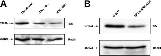 Figure 7. FOXO3a target p27kip1 is down-regulated in cells inducibly or constitutively expressing NPM-ALK. (A) Western blot analysis of p27kip1 expression levels in TonBaF.1 cells inducibly expressing NPM-ALK 24 hours after the addition of 2 μg/mL doxycycline. Uninduced samples were harvested from cells starved of IL-3 for 17 hours. +Dox 24hr samples were harvested from cells starved of IL-3 for 17 hours and induced with 2 μg/mL doxycycline for 24 hours. Whole-cell lysates were fractionated by SDS-PAGE and immunoblotted with p27kip1-specific antibody. The membrane was stripped and reblotted with Rack1-specific antibody to confirm equal loading. (B) Western blot analysis of p27kip1 expression in Ba/F3 cells stably transformed with NPM-ALK. Whole-cell lysates of MSCV- and MSCV-NPM-ALK-transduced Ba/F3 cells were harvested after a 17-hour IL-3 starvation, fractionated by SDS-PAGE, and immunoblotted with p27kip1-specific antibody. The membrane was stripped and reblotted with Rack1-specific antibody to confirm equal loading.