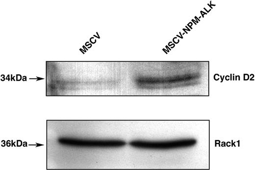 Figure 8. FOXO3a target cyclin D2 is up-regulated in cells stably transformed by NPM-ALK. Western blot analysis of cyclin D2 expression levels in Ba/F3 cells stably transformed with NPM-ALK. Whole-cell lysates of MSCV- and MSCV-NPMALK-transduced Ba/F3 cells were harvested after a 17-hour IL-3 starvation, fractionated by SDS-PAGE, and immunoblotted with cyclin D2-specific antibody. The membrane was stripped and reblotted with Rack1-specific antibody to confirm equal loading.