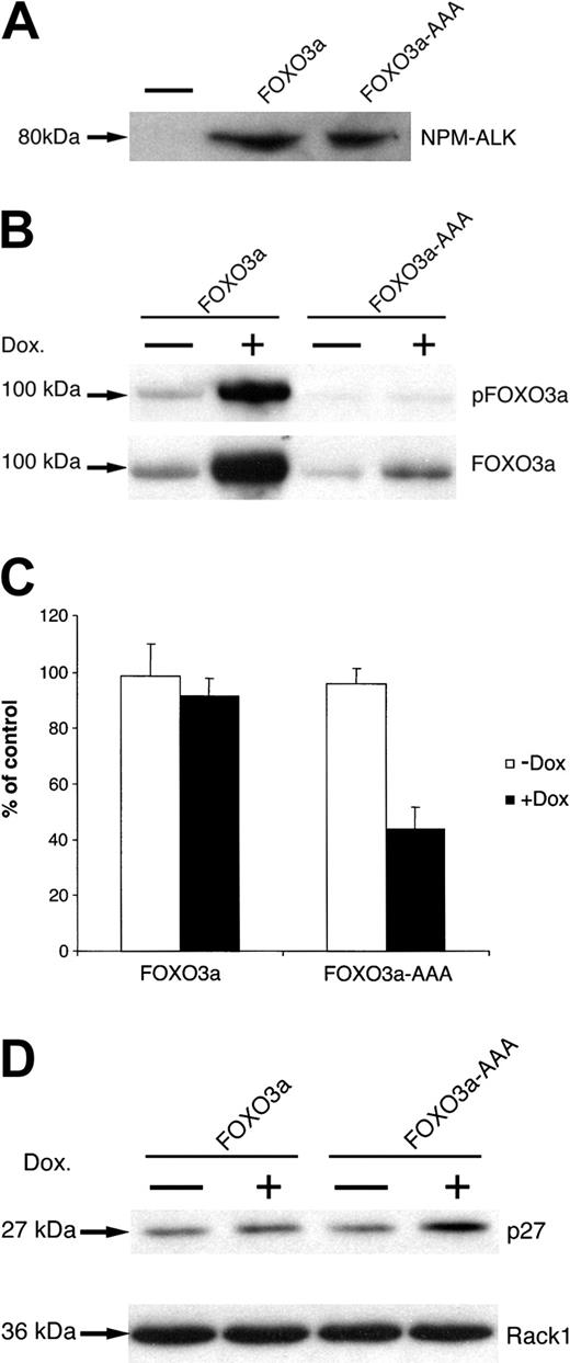 Figure 9. Constitutively active FOXO3a (FOXO3a-AAA) inhibits the proliferation of NPM-ALK-transformed Ba/F3 cells. (A) Expression of NPM-ALK in TonBaF.1-FOXO3a and TonBaF.1-FOXO3a-AAA cells stably transformed with NPM-ALK. Whole-cell lysates were fractionated by SDS-PAGE and immunoblotted with ALK-specific antibody. The minus signs represent parental TonBaF.1 cells. (B) Expression of FOXO3a or FOXO3a-AAA in TonBaF.1-FOXO3a and TonBaF.1-FOXO3a-AAA cells stably transformed with NPM-ALK after 72-hour incubation with 2 μg/mL doxycycline. Whole-cell lysates were fractionated by SDS-PAGE and immunoblotted with antiphospho-FOXO3a (Thr32)-specific antibody. The membrane was stripped and reprobed with anti-FOXO3a-specific antibody. (C) Effect of FOXO3a or FOXO3a-AAA expression on the proliferation of NPM-ALK-transformed Ba/F3 cells. Thymidine incorporation assay was performed after 72 hours of culture. Values represent the mean ± SD of triplicate cultures and are expressed as percentages of uninduced control cells. (D) Western blot analysis of p27kip1 expression in TonBaF.1-FOXO3a or TonBaF.1-FOXO3a-AAA cells stably transformed with NPM-ALK. Whole-cell lysates were harvested and fractionated by SDS-PAGE and immunoblotted with p27kip1-specific antibody. The membrane was stripped and reprobed with Rack1-specific antibody to confirm equal loading.