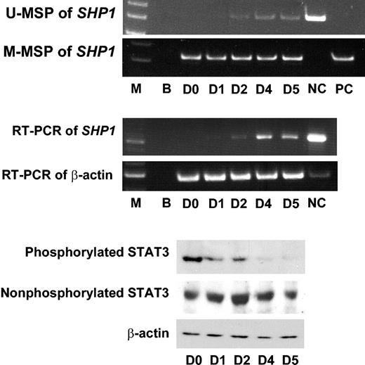 Figure 5. 5-Azacytidine (5-AC) treatment of the myeloma line U266. The U266 cell line was totally methylated at SHP1, as shown by positive amplification only in M-MSP and not U-MSP at day 0 (D0) before treatment with 5-AC. On treatment with 5-AC, positive amplification appeared in U-MSP on day 2 (D2), indicating SHP1 demethylation. The U-MSP amplification became progressively stronger until day 5 (D5), indicating increasing demethylation of SHP1. The progressive demethylation of SHP1 was associated with increasing reexpression of SHP1, as shown by increasing amplification intensity of SHP1 mRNA by reverse transcription PCR (RT-PCR). Western blot analysis of STAT3 showed that before treatment (D0), phosphorylated STAT3 was constitutively expressed. With progressive demethylation and reexpression of SHP1, there was progressive down-regulation of phosphorylated STAT3, without significant changes in the amount of nonphosphorylated STAT3. By day 5 (D5), phosphorylated STAT3 was almost undetectable. Comparable protein loading was shown by β-actin. M indicates molecular weight marker; B, blank; D0 to D5, days 1 to 5 after 5-AC treatment; NC, normal control; PC, positive control with methylated DNA.