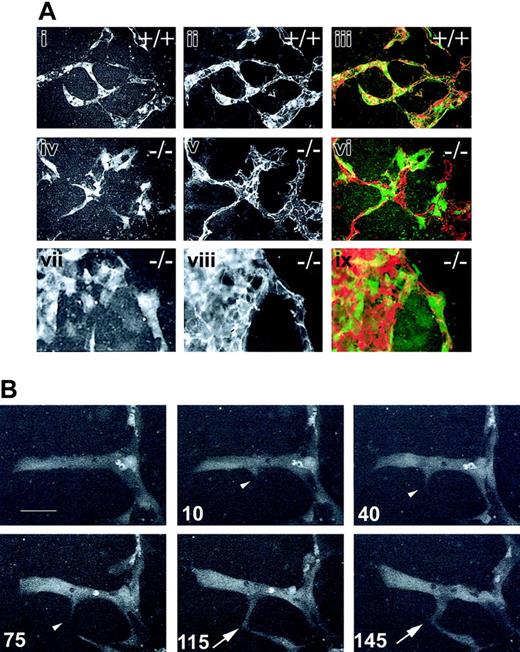 Figure 1. GFP expression allows for visualization of mammalian sprouting angiogenesis. Stable ES cell lines expressing PECAM-GFP were generated (see “Materials and methods”) and subjected to time-lapse image analysis of vascular processes for 4.5 to 9.5 hours. (A) Day-8 WT-eGFP (+/+, i-iii) or flt-1-/--eGFP (-/-, iv-ix) ES differentiation cultures were imaged by time-lapse at 1-minute intervals for 4.5 to 9.5 hours, then fixed and reacted with an anti-PECAM antibody. The last frame captured (i,iv,vii) was overlayed (iii,vi,ix) with the PECAM-stained image (ii,v,viii). Original magnification × 20. (B) Time-lapse frames of a day-8 WT-eGFP ES differentiation culture showing the formation of a vascular sprout and its fusion with another sprout. Time in minutes is at bottom left of each frame. The white arrowhead indicates sprout formation and extension; the white arrow, the fusion of the sprout tip with the second sprout. Scale bar in panel B is 20 μm (Supplemental Movie S1).