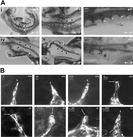 Figure 4. Sprouting from the dorsal aorta is reduced in the absence of flt-1 (A) The 8.5-dpc embryos that were WT (+/+; i-ii), flt-1+/- (+/-; iii), or flt-1-/- (-/-; iv-vi) were collected and whole-mount stained with an anti-PECAM antibody. (i-iii) In 3 different normal embryos, intersomitic vessels (white arrows) branch from the dorsal aorta (black arrowheads). A magnified view in panel iii shows several intersomitic sprouts (white arrowheads) in register posterior to the vessels. (iv-vi) Two different flt-1-/- embryos show few branches from the dorsal aorta, and those that are seen are often stunted (black arrows). The inset in panels v and vi show stunted sprouts with blunted tips. A indicates anterior; and P, posterior. Original magnification × 5. (B) Day-8 WT (i-iv) and flt-1-/- (v-viii) ES differentiation cultures were fixed and stained with a PECAM antibody. Representative sprouts were photographed. Note that most WT sprouts are tapered at the distal end (white arrowheads), while most flt-1-/- mutant sprouts are blunted (white arrows) at the distal end. Original magnification × 60.