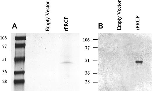 Figure 1. Recombinant PRCP. Schneider insect (S2) cells were transfected with either 19 μg pMT/BiP/V5-His C (empty vector) or 19 μg rPRCP-pMT/BiP/V5-His C (rPRCP). The full-length rPRCP was purified from serum-free medium as shown by colloidal Coomassie blue-stained SDS-PAGE (A) or immunoblot with goat antibody to PRCP (B).