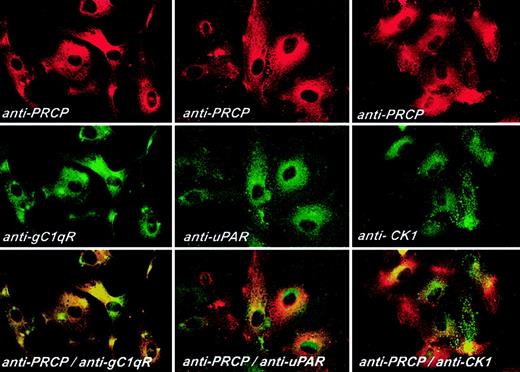 Figure 6. Colocalization of PRCP with HK receptors. HUVECs were grown on microscope slides for 2 hours and then fixed with 2% paraformaldehyde and not permeabilized. Fixed cells were then incubated with goat anti-PRCP and anti-gC1qR, anti-uPAR, or anti-CK1 for 1 hour at 37°C. After washing, the anti-PRCP antibody was detected with Alexa Fluor 594-labeled secondary antibodies. Anti-gC1qR, -uPAR, and -CK1 antibodies were detected with FITC-conjugated secondary antibodies, as described in “Materials and methods.” Original magnification × 60.