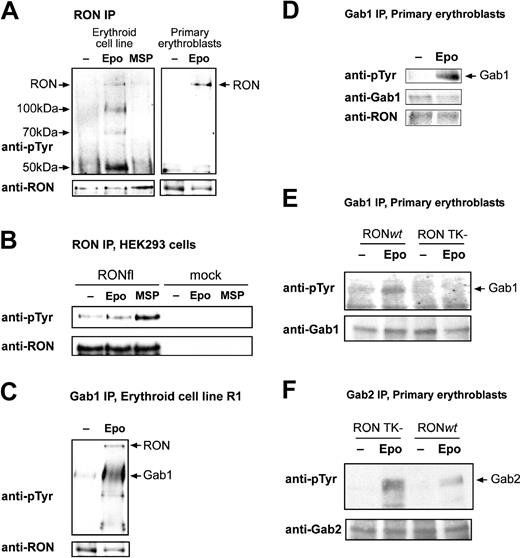 Figure 3. Gab1 is an interaction partner and a substrate of RON in erythroblasts. (A) Immortalized (R1) and primary fetal liver-derived erythroblasts were factor deprived and subsequently stimulated with EPO (5 U/mL; 10 minutes) or MSP (100 ng/mL; 10 minutes). Anti-RON immunoprecipitates were analyzed for proteins phosphorylated on tyrosine using monoclonal PY99. Blots were stained with anti-RON to control phosphorylated protein comigration with RON and to control loading. Arrows indicate the position of RON and the position plus molecular weight of phosphorylated coimmunoprecipitated proteins. Anti-RON did not stain a 150-kDa protein in immunoprecipitates obtained with unrelated antibodies (eg, anti-Btk; data not shown), indicating that the 150-kDa band is specific for the anti-RON immunoprecipitate. (B) HEK293 cells were mock transfected or transfected with pSG5-RONfl, serum deprived, and stimulated with EPO (5 U/mL; 10 minutes) or MSP (100 ng/mL; 10 minutes). Anti-RON immunoprecipitates were tested for RON phosphorylation, as described for panel A. (C-D) Erythroblast cell line R1 (C) and fetal liver-derived erythroblasts (D) were factor deprived and restimulated with EPO (5 U/mL; 10 minutes). Gab1 was immunoprecipitated, and blots were stained with antiphosphotyrosine antibodies (PY99) and antibodies against Gab1 and RON, as indicated. (E-F) Fetal liver-derived erythroblasts derived from RON TK-/-embryos and wt littermates were factor deprived and restimulated with EPO (5 U/mL; 10 minutes). Western blots containing Gab1 and Gab2 immunoprecipitates were stained with antiphosphotyrosine and with anti-Gab1 or anti-Gab2 to check equal loading.