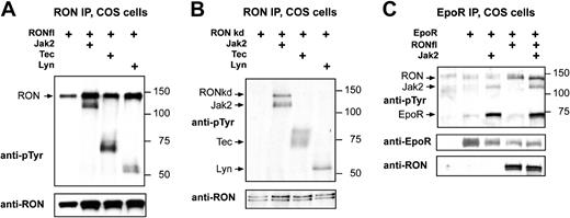 Figure 4. RON forms a complex with the EpoR and is a substrate of Jak2. (A-B) COS cells were transfected with pSG5-based expression constructs encoding RONwt (A) or RONkd (B), together with Lyn, Tec, and Jak2. Cells were harvested without factor stimulation. (C) COS cells were transfected with RONwt, together with EpoR and Jak2, and were stimulated with EPO (5 U/mL) 10 minutes before cell harvest. (A-C) Two days after transfection, COS cells were lysed, and RON (A-B) or EpoR (C) was immunoprecipitated. Immunoprecipitated proteins were subjected to SDS-PAGE and immunoblotting. Size markers are indicated in kDa. Upper panels represent blots stained with antiphosphotyrosine antibodies (PY99), and lower panels represent blots stained with anti-RON, anti-EpoR, or both, when appropriate. Arrows indicate the positions of the expressed proteins.