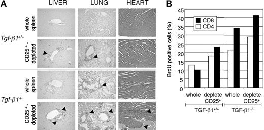 Figure 3. Depletion of CD25-expressing cells from Tgf-β1-/- spleen cells accelerated lymphocyte expansion and inflammation in Rag2-/- recipients. Whole splenocytes or CD25-depleted splenocytes (1 × 107 cells/mouse) from Tgf-β1+/+ or Tgf-β1-/- donor mice were transferred into Rag2-/- recipient mice. (A) H&E-stained sections of heart and CD3 immunostained sections of liver and lung of Rag2-/- recipients of whole or CD25-depleted splenocytes are shown. Original magnification, × 100. (B) BrdU-positive CD4+ and CD8+ cells in spleens from the recipients are shown. One representative result from 5 separate analyses is shown.