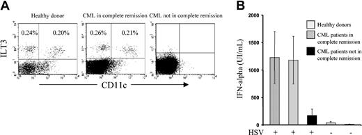 Figure 2. Imatinib restores PDC function in vivo. (A) PBMCs isolated from healthy volunteers or patients with CML treated with imatinib were analyzed by flow cytometry after 3-color staining with a combination of FITC-labeled monoclonal antibodies against lineage markers (CD3, CD14, CD16, CD19, and CD56), phycoerythrin (PE)-labeled anti-CD11c and phycoerythrin-cyanin 5.1 (PC5)-labeled anti-ILT3. Two distinct populations of lin-/ILT3+ cells were observed with respect to the expression of CD11c with the phenotypes of lin-/CD11c+/ILT3+ (myeloid DCs) and lin-/CD11c-/ILT3+ (PDCs). Examples of results obtained from more than 15 healthy volunteers (left panel), 7 patients with CML in complete cytogenetic or molecular remission after imatinib treatment (middle panel), and 2 patients with CML not reaching cytogenetic or molecular remission after imatinib treatment (right panel). P = not significant for comparison of PDC numbers between healthy donors (left panel) and patients with CML in complete cytogenetic or molecular remission after imatinib treatment (middle panel). Percentages in upper left quadrants denote PDCs; in upper right quadrants, myeloid DCs. (B) IFN-α secretion by PDCs from healthy donors and patients with CML receiving imatinib treatment following stimulation with HSV. Cells were stimulated with HSV without any additional cytokine. Supernatants were harvested after 48 hours of stimulation. IFN-α secretion was analyzed by ELISA. Concentrations obtained from 104 PDCs are represented as the mean and SEM of IFN-α secretion obtained from 5 healthy donors, 5 patients with CML in complete cytogenetic or molecular remission after imatinib treatment, and 2 patients with CML not reaching cytogenetic or molecular remission after imatinib treatment. P = not significant for comparison of IFN-α secretion between healthy donors and patients with CML in complete cytogenetic or molecular remission after imatinib treatment. Control conditions that were not stimulated with HSV did not contain detectable or significant amounts of IFN-α.