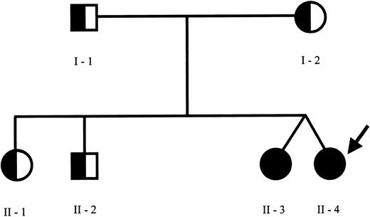 Figure 1. Family pedigree. Pedigree of the family members indicating the subjects carrying the C272T mutation of PRF1 gene at homozygous (closed circles) or at heterozygous (half circles) status. The proband is indicated by the arrow. The PRF1 sequence analysis revealed the presence of C272T (causing the A91V missense mutation) at the homozygous status in the proband and her fraternal twin and at the heterozygous status in the other family members. Furthermore, an additional G695A mutation (causing the R231H missense mutation) at the heterozygous status was found in the proband, in the healthy twin sister, and in the father.