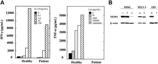 Figure 1. The differential responses of the patient's PBMCs are due to differential expression of NEMO in each lineage. (A) Defective response of the patient's PBMCs to LPS but not to IL-18. PBMCs from the patient and healthy controls were stimulated with varying doses of IL-18 plus IL-12 (20 ng/mL) or with varying doses of LPS plus IFN-γ (5000 U/mL). A representative of 2 consistent results is shown. (B) Western blotting analysis of NEMO. Fifty micrograms of PBMC cell lysates (lanes 1-3), HTLV-I-transformed cells (lanes 4-5), and EBV-transformed cells (lanes 6-7) from the patient (lanes 3, 5, and 7) and healthy controls (lanes 1, 2, 4, and 6) were used. β-actin was used as a control for equal loading (lanes 1-7).