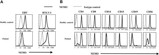 Figure 2. Analysis of NEMO protein expression using intracellular staining and flow cytometry. (A) Intracellular staining of NEMO in EBV-transformed and HTLV-I-transformed cell lines. Solid lines indicate the anti-NEMO mAb, and dotted lines indicate the isotype controls. We confirmed the NEMO specificity with 2 different anti-NEMO mAbs (C73-764, BD; or clone 54, BD) and obtained identical results. (B) Intracellular staining for NEMO in PBMCs from the patient and healthy controls. The results shown were gated on lineage markers. We performed intracellular staining on PBMCs from 10 different healthy controls, all of which showed specific staining for NEMO on every lineage tested.