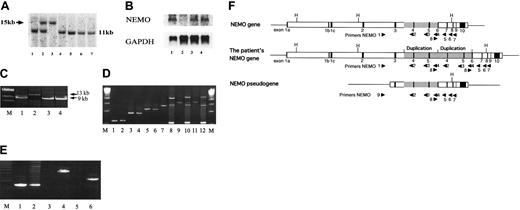 Figure 3. Reduced NEMO expression was caused by duplication of the NEMO gene. (A) Southern blotting analysis of the NEMO gene. Genomic DNA was digested with HindIII and electrophoresed, and the blot was hybridized with exon 2 DNA as a probe. DNA from the patient's EBV-transformed cells (lane 3) showed a 15-kb band, which was shared by his mother (lane 2), instead of the 11-kb bands, which were detected in the DNA from the patient's HTLV-I-transformed cells (lane 4), his father's EBV-transformed cells (lane 1), his mother's EBV-transformed cells (lane 2), and EBV-transformed cells from healthy controls (lanes 5-7). (B) Northern blotting analysis of the NEMO gene. The blot was hybridized with exon 3 DNA as a probe. RNA from the patient's EBV-transformed cells (lane 2) expressed very little NEMO mRNA compared with his HTLV-I-transformed cells (lane 1) and the EBV-transformed cells from healthy controls (lanes 3-4). (C) PCR reaction using primers 1 and 7. Only the NEMO gene was amplified. EBV-transformed cells (lane 2) had a 13-kb band instead of the 9-kb band seen in HTLV-I-transformed cells (lane 1) and healthy controls (lanes 3-4). M indicates lambda/HindIII digestion marker. (D) PCR reaction using primers 1 and 2 (lanes 1-2), primers 1 and 3 (lanes 3-4), primers 1 and 4 (lanes 5-6), primers 1 and 5 (lanes 7-8), primers 1 and 6 (lanes 9-10), and primers 1 and 7 (lanes 11-12). The patient's EBV-transformed cells (lanes 2, 4, 6, 8, 10, and 12) and those of healthy controls (lanes 1, 3, 5, 7, 9, 11) were used as templates. The larger bands detected in lanes 8, 10, and 12 indicate that the insertion is between primers 4 and 5 (between introns 5 and 6). M indicates 2.5-kb ladder. (E) PCR reaction using primers 8 and 5 (lanes 1-2), primers 8 and 3 (lanes 3-4), and primers 8 and 2 (lanes 5-6). The patient's EBV-transformed cells (lanes 2, 4, and 6) and those of healthy controls (lanes 1, 3, and 5) were used as templates. M indicates 1-kb marker. (F) Schematic representation of the normal NEMO gene, the patient's NEMO gene, and the NEMO pseudogene. Primers are shown as triangles. The duplicated region found in the patient is shaded. H indicates HindIII digestion sites.