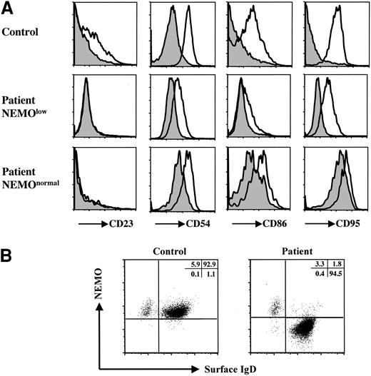 Figure 5. Analysis of the XL-EDA-ID patient's B cells. (A) Recombinant human soluble CD40L stimulation of the patient's B cells induced CD23, CD54, CD86, and CD95 up-regulation to a lesser extent. PBMCs from the patient and healthy controls were treated with (open histograms) or without (shaded histograms) recombinant human soluble CD40L (2.5 μg/mL) for 48 hours. Histograms are shown gated on CD19+ cells of a control, CD19+NEMOlow, and CD19+NEMOnormal cells of the patient. (B) IgD-CD19+ class-switched B cells were NEMOnormal. PBMCs from the patient and healthy controls were stained with CD19, NEMO, and IgD, and CD19+-gated cells are shown.