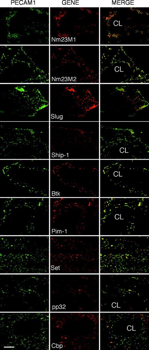 Figure 4. Genes expressed in Flk-1-positive endothelial precursors are expressed in endothelial cells of the ovary during angiogenesis. Immunofluorescence analysis on frozen ovary sections at 8 hours of the LP. Endothelial-positive cells were identified by staining with PECAM1 (green) antibody, and specific colocalization was valued by double staining with specific antibodies (red) as indicated. Colocalization analysis was performed with a confocal microscope. CL indicates corpus luteum. Scale bar, 40 μm.