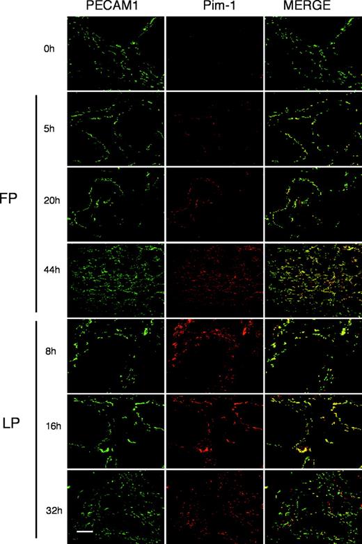 Figure 5. Pim-1 is transiently expressed in ECs of the ovary during angiogenesis. Immunofluorescence analysis on frozen ovary sections at ovaries during the follicular phase (FP) and luteic phase (LP) at the time indicated. Endothelial-positive cells were identified by staining with PECAM1 (green) antibody, and specific colocalization was valued by double staining with Pim-1 antibodies (red) as indicated. Colocalization analysis was performed with a confocal microscope. Scale bar, 40 μm.