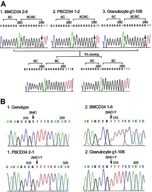 Figure 2. mtDNA mutations and clonal expansions of individual CD34 clones. (A) Reverse-sequence analysis of BM CD34 (clone number 2-6), PB CD34 (clone number 1-2), and single granulocyte (number g1-108) mtDNA from donor 4 showed the same poly C length heteroplasmy (mixture of 8CT6C and 9CT6C) between nucleotide position 303 to 315. Reverse-sequence analysis after TA cloning revealed poly C length heteroplasmy of 8CT6C (bottom left) and 9CT6C (bottom right). (B) Clonal expansion of substitution mutation at mtDNA nucleotide position 264. Sequence chromatogram with aggregate genotype (i) and 264C>T mutation was found in BM CD34 clone (number 1-6) (ii), PB CD34 clone (number 2-1) (iii), and single granulocyte (number g1-106) (iv) from donor 5.