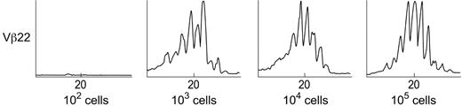 Figure 1. Determination of the sensitivity of the TCR Vβ spectratyping technique. Detection of spectratyping sensitivity was performed on the basis of flow cytometry, and the sorted positive cells were mixed with negative cells to produce fixed proportions of the specific Vβ's in negative cell populations (0, 10, 102,103,104, and 105 Vβ+ cells in 106 cell population for each Vβ subfamily). Total RNA (aapproximately 1 μg) was extracted from cells (106), and standard spectratyping performed. The experiments were repeated 3 times. The lowest cell number detectable in 106 mixed population is 100 to 1000 cells for random selection of Vβ2, Vβ14, and Vβ22.