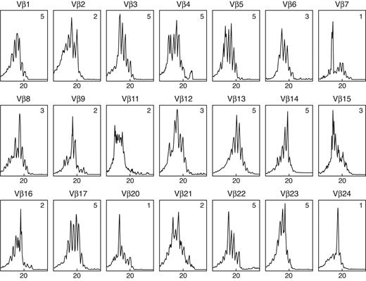 Figure 2. Representative TCR Vβ CDR3 size spectratype obtained from the liver of a patient with HAA showing many highly skewed spectratypes. Vβ13 and Vβ23 show a normal or Gaussian bell-shaped distribution; Vβ7 and Vβ24 demonstrate a skewed spectratype profile with a single dominant peak; Vβ2 and Vβ9 illustrate a skewed spectratype profile with double peaks; Vβ16 shows multiple peaks but with non-Gaussian distribution and skewed spectratype. The complexity score for each spectratype is given in the upper right corner. The overall complexity score was calculated as 70. The abscissa shows CDR3 length (amino acids), and the ordinate shows fluorescence intensity.