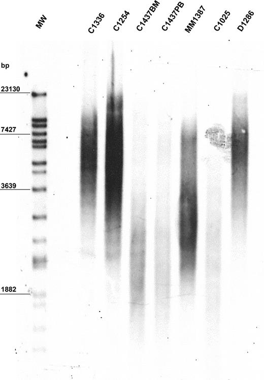 Figure 1. Representative example of TRF length in 6 MBCLD patients. Peak TRF lengths are expressed as base pairs (bp). MW indicates molecular-weight ladder; BM, bone marrow; PB, peripheral blood. C1336 and C1254 are CLL patients with mutated VH; C1437 and C1025 are CLL patients with unmutated VH (C1437 includes C1437BM and C1437PB); MM1387 is a MM patient; D1286 is a DLCL patient.