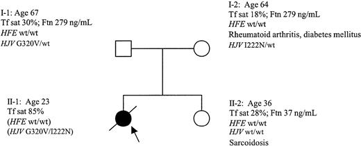 Figure 2. Pedigree of Alabama kinship B with JH. Arrow designates JH index case. Ages (in years) are those at time of manuscript preparation (or death); clinical and laboratory findings reflect observations at the time of diagnosis of JH patients or evaluation of corresponding family members. Tf sat indicates serum transferrin saturation; Ftn, serum ferritin concentration. Determined alleles of HFE and HJV are displayed without parentheses, deduced genotypes within parentheses. The arrows designate the subjects used for DNA analysis.