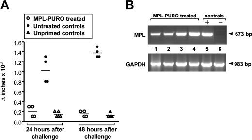 Figure 1. Absence of PLP-specific DTH responses in mice adoptively transferred with MPL-PURO-expressing B cells. (A) Treated and untreated mice in remission were injected with PLP-coupled SRBCs into the front right footpad. The swelling of the injected footpad was compared with the uninjected left footpad 24 and 48 hours later. Each symbol represents one mouse and the horizontal bars represent the mean response of each group. Baseline responses to the antigen challenge alone were measured in unprimed normal control mice. (B) RT-PCR was performed on total RNA extracted from the spleens of mice treated with MPL-PURO-infected B cells and employed in the DTH assays (lanes 1-4). Lanes 6 and 7 are positive and negative control samples prepared from MPL-PURO-infected WEHI-231 B cells and from the spleen of an untreated mouse, respectively. Glyceraldehyde-3-phosphate dehydrogenase (GAPDH) was amplified in all samples indicating equal level of total RNA usage.