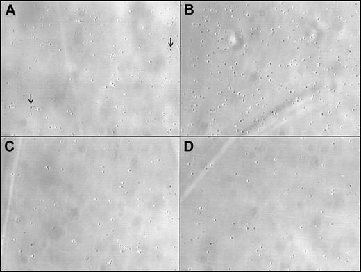 Figure 5. Representative images of firm adhesion of washed human platelets to a fibrinogen-coated membrane in a perfusion flow chamber under high shear. Platelets were either (A) unstimulated (control) or (B) stimulated with recombinant fractalkine (rhCX3C; 1 μg/mL). The proadhesive effect was blocked by either (C) antagonism of rhCX3C (AF537; 100 μg/mL; 30 min) or by (D) disruption of CX3CR1-mediated signaling with PTX (0.4 nM; 45 min). Single spots resemble artifacts due to the setting of the microscope. They are identically existent on every tracing shown (as indicated by the arrow). Original magnification, × 20.