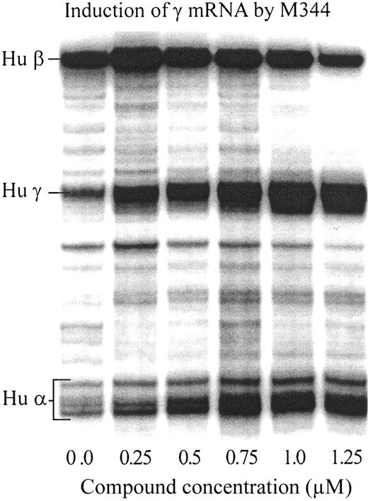 Figure 5. Assessment of effects on globin RNA levels as determined by RNAse protection. RNA from erythroblasts from BFUe's cultured in the presence of increasing concentrations of M344 was used in this experiment. Notice the increase of γ mRNA as the concentration of the compound increases in culture and the reciprocal decrease in the β mRNA. Also notice the increase in α mRNA, indicating that the compound has also nonspecific effects on globin gene expression related to the induction of terminal maturation. It is the decrease in the γ/γ + β ratio that indicates that M344 is a specific γ globin gene inducer.