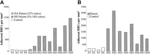 Figure 2. Increased adhesion of human HS RBCs to TSP and LM. Washed RBCs from human controls (□,N1 through N4), a patient with nonspherocytic hemolytic anemia of unknown etiology (▤, HA), and patients with HS (▧, HS1 through HS8) were perfused through flow chambers coated with TSP (A) or LM (B), as described for Figure 1. Adherent RBCs/mm2 are depicted as the mean of duplicate measurements from the same blood sample.