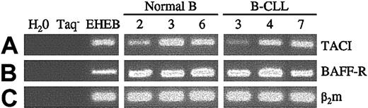 Figure 1. Expression of TACI and BAFF-R mRNAs in normal and leukemic B cells. Total RNA from normal blood-derived B lymphocytes, B-CLL leukemic B cells, and EHEB cells (control) was extracted as previously described, and cDNAs were subjected to PCR amplification with specific primers for TACI (lane A, 327 bp), BAFF-R (lane B, 256 bp), and β2-microglobulin as control (lane C, 169 bp). Negative controls were performed in the absence of cDNA and Taq.