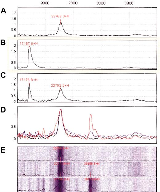 Figure 5. Detection of a soluble form of BAFF in the sera of B-CLL patients by SELDI-TOF MS. (A) Analysis of the protein G chip after affinity binding of the rabbit anti-BAFF antibody. The expected peak of 155 kDa and the different “echoes” corresponding to increasing degrees of ionization are not shown because only proteins in the range of 15 000-40 000 Da are presented for clarity. The 22-kDa peak corresponds to a contaminating protein in the IgG preparation. (B) Analysis of a recombinant soluble form of BAFF (17 kDa; BioVision) on a golden chip. (C) Analysis of the protein G chip after affinity binding of the anti-BAFF antibody and washing and incubation with the recombinant soluble form of BAFF and washing. (D) Analysis of the protein G chip after affinity binding of the anti-BAFF antibody and washing and incubation without (black) or with (blue) normal sera or B-CLL sera (red) and washing. Recordings corresponding to these 3 analyses have been superimposed. (E) Pseudo gel representation of the previous data with separate records for the control (top), normal sera (middle), and B-CLL sera (bottom).