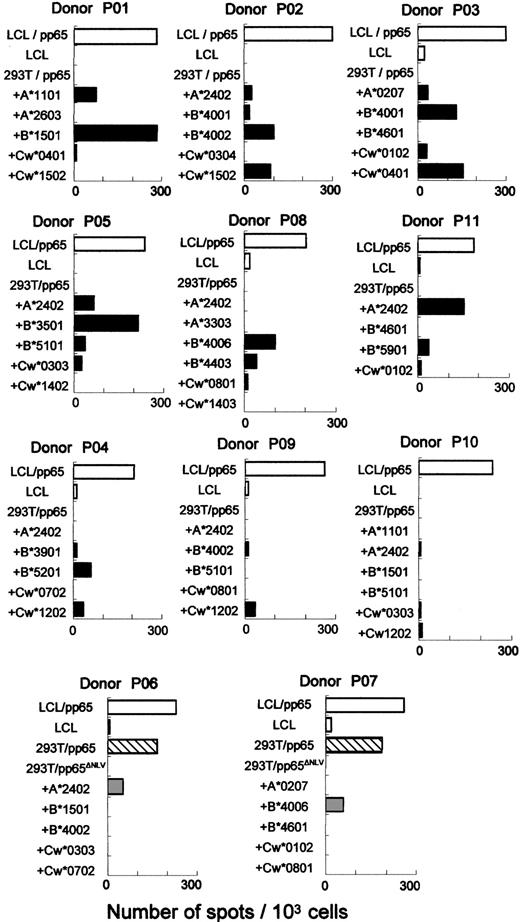 Figure 1. ELISPOT assay for the determination of HLA restriction of the CTL lines generated from CMV seropositive donors. CTL lines generated after the third stimulation with pp65-transduced CD40-B cells were tested for HLA restriction. ELISPOT assays were performed by incubating the CTL line with one of the following: autologous LCL, pp65-transduced autologous LCL (□), 293T cells transfected with both the pp65 gene and the individual HLA cDNA (▪), or the pp65 gene alone (▧). In the case of P06 and P07, CTL lines were found to recognize 293T cells transfected with the pp65 gene alone, due to their endogenous expression of HLA-A*0201. Thus, 293T cells transfected with both mutant pp65 gene (pcDNA3-pp65ΔNLV), lacking a dominant A*0201-restricted epitope (NLVPMVATV), and individual HLA cDNA were used in these cases (▤) (see “Materials and methods”). Each bar represents the number of spots per 103 cells.