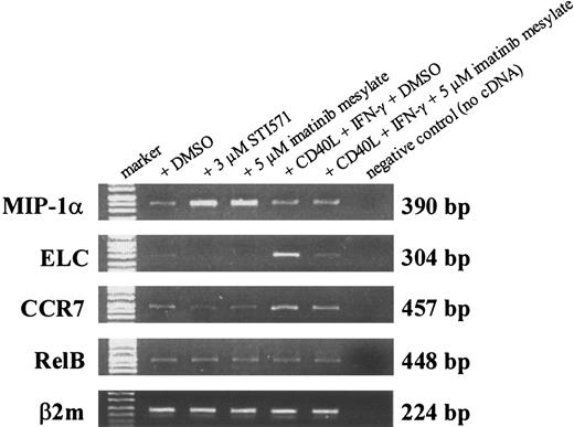 Figure 6. Imatinib mesylate modulates mRNA level of MIP-1α, ELC, and CCR7 in DCs. RNA was extracted from DCs generated from mobilized human CD34+ PBPCs that were cultured in the presence of GM-CSF, TNF-α, IL-4, and FLT3L with or without imatinib mesylate (3 μM and 5 μM). For activation of DCs, cells were incubated with soluble CD40L and IFN-γ 24 hours before harvesting the cells. Transcription of MIP-1α, ELC, CCR7, and RelB was analyzed by RT-PCR. Amplification of β2microglobulin (β2m) served as internal control to ensure the use of equal amounts of cDNA.