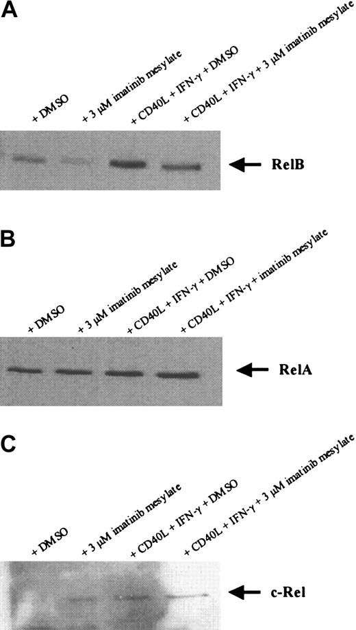 Figure 7. Imatinib mesylate down-regulates the expression of nuclear localized RelB protein but not RelA and c-Rel in DCs. Mobilized human CD34+ PBPCs were cultured in the presence of GM-CSF, TNF-α, IL-4, and FLT3L with or without imatinib mesylate (3 μM). For activation of DCs, cells were incubated with soluble CD40L and IFN-γ 24 hours before preparing nuclear extracts. Nuclear localized RelB (A), RelA (B), and c-Rel (C) protein were detected by SDS-PAGE and Western blot.
