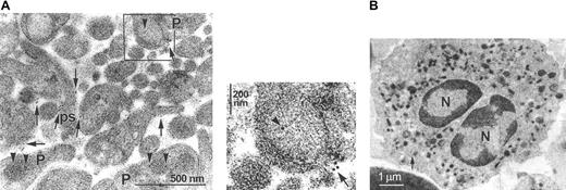 Figure 3. Intraplatelet TF is exposed on the surface of activated platelets and microparticles. (A) (i) In thin sections of suspensions of platelets stimulated with collagen and thrombin, TF is visualized by immunoelectronmicroscopy. TF is located on the plasma membrane of the platelets (P) as well as on their pseudopodia (ps; arrows). The identity of the pseudopodia was verified by analyzing a panel of serial thin sections, which indicated their connection with the platelets. In nondegranulating platelets, TF is located within the membrane of the α-granules (arrowheads). (ii) Direct visualization of the degranulation of an α-granule, resulting in the translocation of TF to the cell surface. The panel represents the magnification of the inset marked in the upper panel. Arrows indicate surface TF, whereas arrowheads indicate intraplatelet TF. (B) Virtual absence of TF staining in immunoelectronmicrographs of rapidly prepared neutrophils. The arrow indicates a single gold particle. N indicates nucleus. Note the different diameter scale compared with panel A.