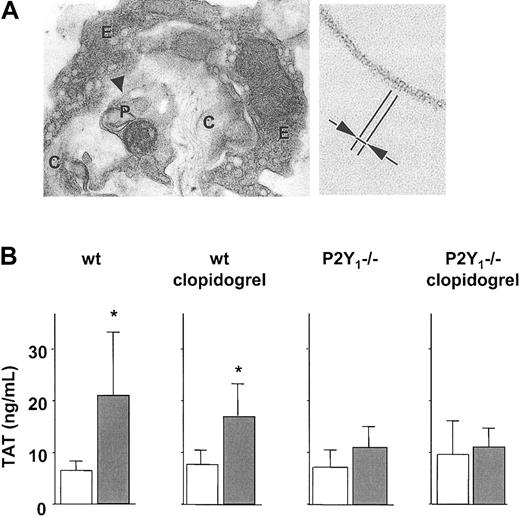 Figure 7. Platelet ADP pathway supports thrombin formation in vivo. (A) Collagen injection elicits intravascular fibrin formation. Transmission electron micrographs of lung from a wild-type (wt) mouse following injection of collagen plus epinephrine. (Left) Thrombus occluding a pulmonary vessel with some rare fibrin fibrils (arrowhead) (E indicates endothelium; C, collagen fibers; and P, platelet). Original magnification, × 14000. (Right) Higher magnification (× 148000) of the fibrin fibrils showing the periodicity of around 20 nm (arrows). (B) Collagen fails to activate thrombin generation in P2Y1 (–/–) mice. Plasma TAT levels following collagen-induced thromboembolism in wt and P2Y1 (–/–) mice, without or with clopidogrel. Empty columns indicate saline injection; filled columns, collagen plus epinephrine. Means ± SDs; n = 7 to 8. *P < .05 compared with same condition without collagen.