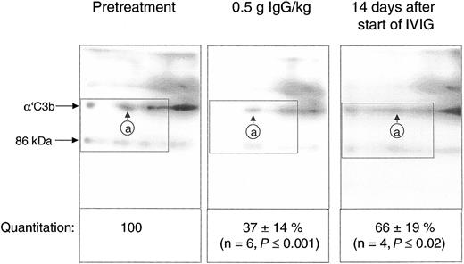 Figure 7. IgG infusion induced a rapid early decline of ester-bonded C3b2-containing complexes in patients. Plasma samples (rapidly denatured plasma) were drawn 1 hour before infusion, after infusion of 0.5 g IgG/kg body weight, and 14 days after the start of the infusion and aliquots were subjected to 2-dimensional electrophoresis. Gels were blotted and α′C3b released from ester-linked complexes was quantified using labeled mAb H206. A blot from consecutive samples of an amyopathic patient is shown. The circled letter a refers to the position of α′C3b2-HC in the first dimension. The dotted rectangle indicates the area comprising the mAb H206-reactive polypeptides α′C3b and a fragment of α′C3b with an apparent MW of 86 kDa. The 86-kDa fragment originated from cleavage of C3bn-containing complexes while plasma was yet in contact with cells. It was not found in serum activated by exogenous immune complexes and was also not identical with the N-terminal 65-kDa fragment, because H206 bound exclusively to the C-terminal portion of α′C3b (Figure 1 H206). The 86-kDa fragment most likely represented the large, C-terminal fragment of α′C3b, generated by factor I and CR135 before plasma was separated from cells. For quantification of released α′C3b label within rectangles was determined and normalized to pretreatment values. Results are given as means ± SD. Data taken at 0.5 g IgG/kg body weight were from 2 amyopathic (B and G) and 4 myopathic (F, H, I, and L) patients, those at 14 days from the 3 amyopathic and the myopapthic patient H treated for the first time with 2 g/kg body weight within 2 days.