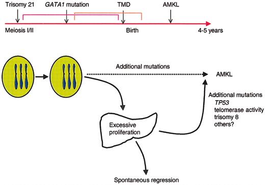 Figure 4. Model for the progression of TMD and AMKL in DS. Trisomy 21 likely represents the initiating event in leukemogenesis of DS because it occurs very early in embryogenesis. The subsequent mutagenesis of GATA1 and selection of progenitor cells that harbor GATA1 mutations may be the second initiating event that leads to the neonatal appearance of TMD in at least 10% of infants with DS. In the majority of infants with TMD, the GATA1 mutant clones disappear during remission, but 30% of the time, the mutant clones acquire additional mutations that promote the development of acute leukemia by the age of 4 years.