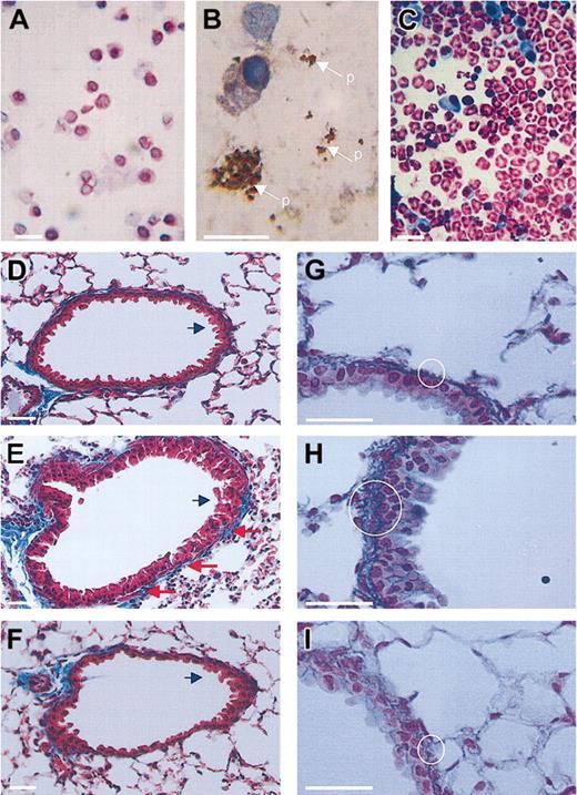 Figure 4. Histologic analysis of murine peripheral airways. (A-C) Bronchoalveolar lavage cytospins obtained from sham-immunized (A) and OVA-immunized (B-C) mice were stained with CD41 immunoperoxidase and Gill hemotoxylin (A-B), or hemotoxylin and eosin (C). Note the presence of platelet aggregates (p; arrow) in cytospin from OVA-immunized mice (B). (D-I) Sections from distal airways of sham-immunized (D,G) and OVA-immunized (E,H) mice and OVA-immunized mice rendered thromobcytopenic following treatment with busulfan (F,I). Sections were stained with either Masson trichrome (D-F) or Gordon and Sweet silver stain (G-I). Red arrows in panel E indicate airway smooth muscle. Blue arrows in panels D-F indicate epithelium. White circles in panels G-I represent regions of subepithelial fiber deposition. Horizontal white bars represent 20.0 μm. Original magnifications: A,C-F, × 40 objective; B,G-I, × 100 objective.