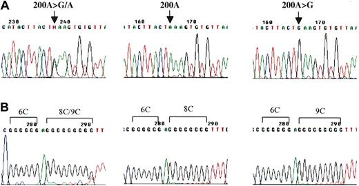 Figure 2. mtDNA heterogeneity in individual CD34+ clones. (A) Sequence chromatogram with mixed nucleotide signal (G/A) at nucleotide position 200 in HV2 from 1 CD34+ clone of BM donor no. 6 (left), and then was clearly divided into wild type (center) and mutation (200A>G/A) (right) after TA cloning. (B) Poly C length heteroplasmy between nucleotide position 303 and 315 from one of the CD34+ clones of BM donor no. 3 (left). Reverse-sequence analysis after TA cloning revealed poly C length heteroplasmy of 8CT6C (center) and 9CT6C (right).