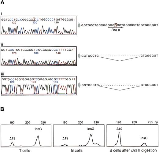 Figure 1. Sequence and GeneScan analysis of DNA from purified lymphocyte fractions. (Ai) WASP exon 10 genomic sequence surrounding the 1305insG mutation. DNA was isolated from sorted, WASP-negative T cells3 of patient II-1. The original 1305insG mutation is highlighted by a red box, and the DraII recognition sequence is underlined. (Aii) Sequence analysis of the same genomic region as in (i) performed on DNA isolated from sorted, WASP-positive T cells and showing the presence of Δ19bp. (Aiii) Sequence of the gel-purified Δ19bp fragment amplified from DNA obtained from sorted B cells after DraII digestion. (B) GeneScan analysis of specific 1305insG (insG) and Δ19bp (Δ19) fragments obtained from DNA isolated from purified CD3+ T cells and CD20+ B cells before and after digestion with DraII.
