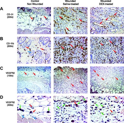 Figure 6. Histologic assessment of wound healing and response to DEX. Paraformaldehyde-fixed and stained sections are shown from the skin of nonwounded mice and from mouse wounds isolated 7 days after wounding in female Vegfr2-luc mice treated with saline or DEX (n = 4 per group). Sections were taken vertically through the granulated tissue extending from the surface into the adipose and skeletal muscle. In the sections shown, the surface of the skin or granulated tissue is at the top of the image, and in some images the deeper adipose tissue and skeletal muscle are readily visible. (A) Blood vessels (red arrows) were visualized by staining with an anti-CD31 antibody. The granulation tissue of saline-treated wounds showed blood vessels that were of relatively small caliber. In DEX-treated wounds, the blood vessels in the granulated tissue were of larger caliber. Dermal blood vessels in the normal nonwounded skin tissue were substantially less dense. Original magnification, × 200. (B) Infiltration of leukocytes was visualized by staining with anti-CD11b antibody. There were few scattered leukocytes (red arrows) in normal nonwounded skin. Blue arrow points to hair follicles in normal skin. Saline-treated wounds had significant leukocyte infiltration that appeared to consist predominantly of macrophages. DEX-treated wounds had markedly less macrophage infiltration. Original magnification, × 200. (C) The presence of the VEGFR2 receptor in the tissue was assessed by immunohistochemical staining with an anti-VEGFR2 antibody. Compared with normal nonwounded skin tissue, saline-treated wounds showed increased staining in endothelial cells and in stromal cells. Staining intensity was higher in cells closest to the lesioned epithelium of the wound, with less staining in deeper tissue. Red arrows indicate blood vessels. DEX-treated wounds had less VEGFR2 staining. Original magnification, × 100. (D) At a higher magnification, the specific cell types that positively stained for VEGFR2 were more apparent. Red arrows indicate blood vessel endothelial cells, green arrows indicate stromal cells, and blue arrows indicate skeletal muscle cells. Original magnification, × 400.