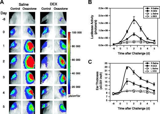 Figure 7. Dexamethasone inhibits Vegfr2-luc expression and ear swelling produced by CHS. (A) Two groups (n = 8) of female Vegfr2-luc mice were sensitized with oxazolone on day –6. On day 0 the right ears were challenged with oxazolone and the left ears were treated with vehicle. Mice were intraperitoneally injected with DEX (10 mg/kg) or saline daily beginning 1 day before the oxazolone challenge. Imaging analysis was performed on the sensitization day (day –6) and daily after oxazolone challenge (day 0). (B) Quantification of luciferase expression (photons/sec) in all the ears with LivingImage software (Xenogen). Data are presented as mean ± SE (n = 8). (C) Ear thickness was measured daily with a micrometer. Data represent mean ± SE (n = 8).