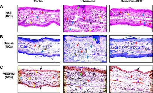 Figure 8. Histologic assessment of ears during induction of CHS and response to DEX. Paraformaldehyde-fixed serial sections of mouse ear were prepared from female Vegfr2-luc mice 2 days after challenge. (A) H&E staining (original magnification ×400). Normal mouse ear has blood vessels (red arrows) in normal dermis. Blue arrows point to lymphatic vessels. After treatment with oxazolone, the ear was thickened because of the infiltration of inflammatory cells and edema. Dilated lymphatics (blue arrows) are also present after oxazolone treatment. Dermal vessels (red arrows) contain red blood cells and white blood cells. Ear cartilage, denoted by the letter C within this panel, is surrounded by dermal inflammatory infiltrate. An intraepidermal abscess (green arrow) is present, and the surrounding epidermis is hyperplastic. Yellow arrows identify sebaceous glands. Sensitized mice exposed to oxazolone and treated with DEX have minimal dermal inflammatory cell infiltration. (B) Giemsa staining, (original magnification × 400). Normal control skin has dermal mast cells (brown arrows) in association with the connective tissue surrounding ear cartilage. The ear treated with oxazolone is markedly thickened with prominent enlarged mast cells (brown arrows), dilated lymphatics (blue arrows), and dermal blood vessels (red arrows) in a hypercellular dermis containing a mixed population of inflammatory cells. An intraepidermal abscess (green arrow) is present, and the adjacent epidermis is hyperplastic. The ear treated with oxazolone and DEX resembles normal ear. (C) Staining with an anti-VEGFR2 antibody (original magnification × 400). Normal control ear shows positive peroxidase staining (indicated by the brown tint) in cells in the epidermis (black arrow) and sebaceous gland (yellow arrow). Ears treated with oxazolone show increased VEGFR2 staining in endothelial cells of blood vessels in the dermis (red arrow) and epidermis (black arrow). The oxazolone-treated ears also show some staining for VEGFR2 protein in skeletal muscle cells (purple arrow). Some dermal inflammatory cells also show staining. Epidermal hyperplasia is clearly shown. Generally, increased staining for VEGFR2 is found in the ears after oxazolone treatment; however, this is not specific for the endothelial cells. Ears treated with oxazolone and DEX have VEGFR2 staining in the epidermis (black arrow), endothelial cells of blood vessels (red arrow), and skeletal muscle cells (purple arrows). Overall VEGFR2 staining is reduced in ear tissues of DEX-treated mice.