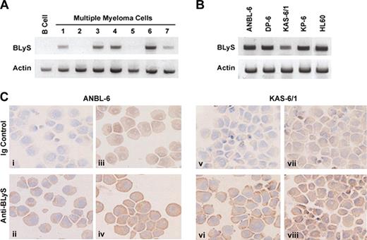 Figure 4. Expression of BLyS in myeloma cells. Expression of BLyS mRNA was analyzed by RT-PCR in 7 CD138+ primary MM cell samples or CD19+ resting B cells (A) or in a panel of MM cell lines (B). The HL60 monocytic cell line was used as a positive control. (C) Immunohistochemical analysis of BLyS expression in ANBL-6 and KAS-6/1 MM cell lines was performed as described in “Materials and methods.” The antibody used in panels ii and vi was specific for membrane-bound BLyS (Alexis Biotechnology), whereas the antibody used in panels iv and viii was specific for soluble and membranebound BLyS (R&D Systems). Corresponding isotype controls are shown in panels i, iii, v, and vii. Original magnification, ×200.