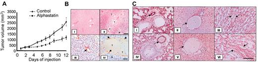 Figure 4. In vivo effects of alphastatin. In vivo effects of alphastatin on (A) the volume and (B) histologic appearance of CT26 tumors grown in Balb/C mice. Data are shown as mean ± SEM. (B) Tumors were excised from control (i,iii) or alphastatin-treated (ii,iv) mice and general morphology/histology was examined at low magnification (i-ii, bar = 100 μm) or stained with an antimurine CD31 antibody and viewed at higher magnification (iii-iv, bar = 50 μm). Cells in control tumors exhibited a compact regular morphology (i) with many patent vessels in the viable regions (white arrows; i) lined with a continuous single layer of endothelial cells (iii). By contrast, alphastatin-treated tumors exhibited an irregular overall morphology with increased levels of necrosis (N; ii,iv) and large distended vessels found in areas of viable tumor as well as in areas of necrosis (as in ii,iv) showing a central thrombosis (T; ii,iv) and lined with patchy incomplete endothelial cells (arrows; iv). (C) No effect of alphastatin injections was evident on the vascular endothelium of nonmalignant murine tissue in vivo. CD31+ cells lining vessels in a range of nonmalignant tissues (arrows); lungs (i,iv), liver (ii,v), and kidneys (iii,vi) from mice were unaffected by alphastatin treatment (iv-vi) and resembled those from control (i-iii) mice. Bar in vi = 50 μm.
