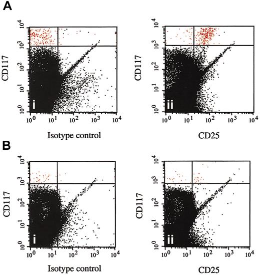 Figure 5. Disappearance of CD25+ bone marrow mast cells following imatinib mesylate therapy. Multicolor flow cytometry results are shown for CD117+ high, side-scatter high bone marrow cells from a representative patient with the myeloproliferative variant of HES before (A) and at 1 month after (B) the initiation of therapy with imatinib mesylate. Cells were stained with FITC-conjugated mouse IgG1 control antibody (isotype control) and antihuman CD25 antibody (CD25). CD117+ high, side-scatter high bone marrow mast cells are shown in red and express CD25 prior to (Aii) but not following (Bii) imatinib mesylate therapy.