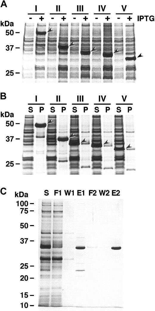 Figure 2. Preparation of bacterial recombinant proteins. (A) Expression. Arrowheads indicate 5 recombinant proteins expressed in E coli after IPTG induction: GST-D1459R1668-H (I), GST-E1554R1668-H (II), GST-D1587R1668-H (III), GST-D1596R1668-H (IV), and GST-D1596R1659-H (V). Gels after SDS-PAGE were stained with GelCode Blue (Pierce, Rockford, IL). The sizes of the protein standards are indicated at the left. (B) Fractionation. Recombinant proteins I and II were collected in pellet fractions (P) after centrifugation, whereas III, IV, and V were in soluble fractions (S). (C) Purification. All the recombinant proteins were purified by 2 sequential column-chromatography procedures, nickel-ion chelating chromatography and glutathione-affinity chromatography. The representative pattern of GST-D1596R1668-H is shown. S indicates soluble fraction of bacterial lysate; F1, flow-through of nickel-ion column; W1, wash; E1, eluate; F2, flow-through of glutathione column; W2, wash; and E2, eluate.