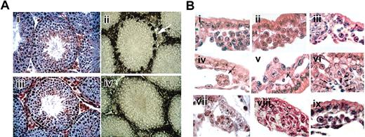 Figure 1. Histological sections of targeted mice. (A) Testis of wild-type and GATA-1–-tg mice. Hematoxylin-eosin staining of testis section. (i) Wild-type and (iii) GATA-1–-tg. Gross histology of testis section was unremarkable. GATA-1 antibody (N6) staining of testis section. (ii) Wild-type, (iv) GATA-1–-tg. GATA-1 signals were detected in Sertoli cells in wild-type (white arrow) but were absent in GATA-1–-tg testis. (B) Histology of yolk sac. Hematoxylin-eosin staining of E8.5 YS paraffin sections. Wild-type (i), GATA-1– (ii), GATA-2–/– (iii), GATA-1–//GATA-2–/– double-knockout (iv-vi) YS, and GATA-1–//GATA-2–/– double-knockout-tg (ix), stained E9.5 YS paraffin section. GATA-1–//GATA-2–/– double-knockout and SCL/tal1–/– (viii). Note that the double-knockout YS has no evident blood cells (iv-vi); however, the double-knockout with the rescue tg has blood cells in the vascular plexus (ix). Cell masses evident in the vascular plexus of the double-knockout (vii) and SCL/tal-1–/– (viii) at E9.5 consist of tightly packed clusters without round hematopoietic cells. Arrow (iv) indicates abnormal cell mass in double-knockout YS. Arrows (v, vi, viii) indicate apoptotic cells.